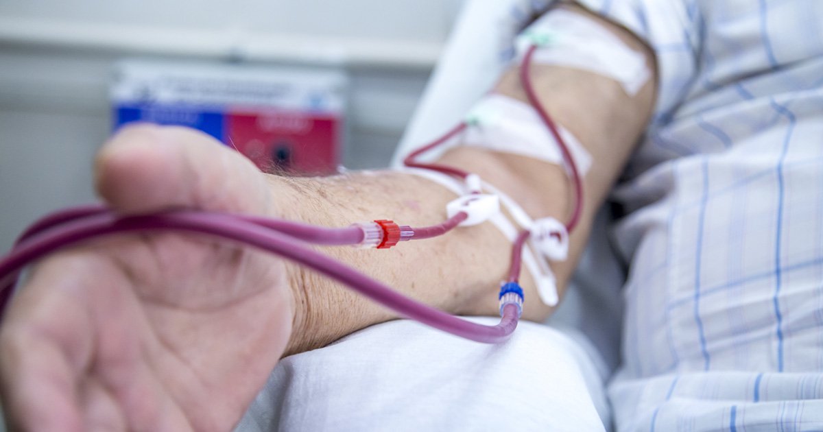 Dialysis Access in preparation for Dialysis Treatment